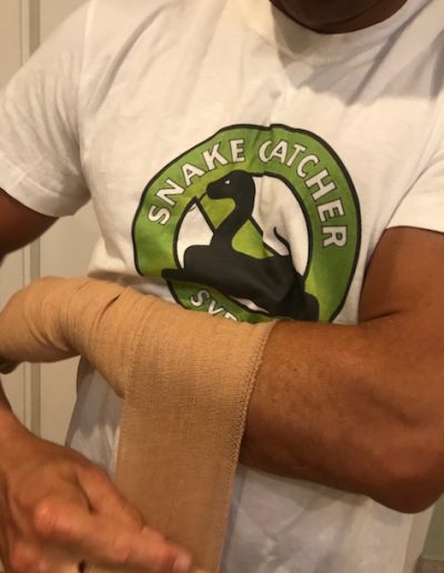 Snake Bite First Aid Treatment 7